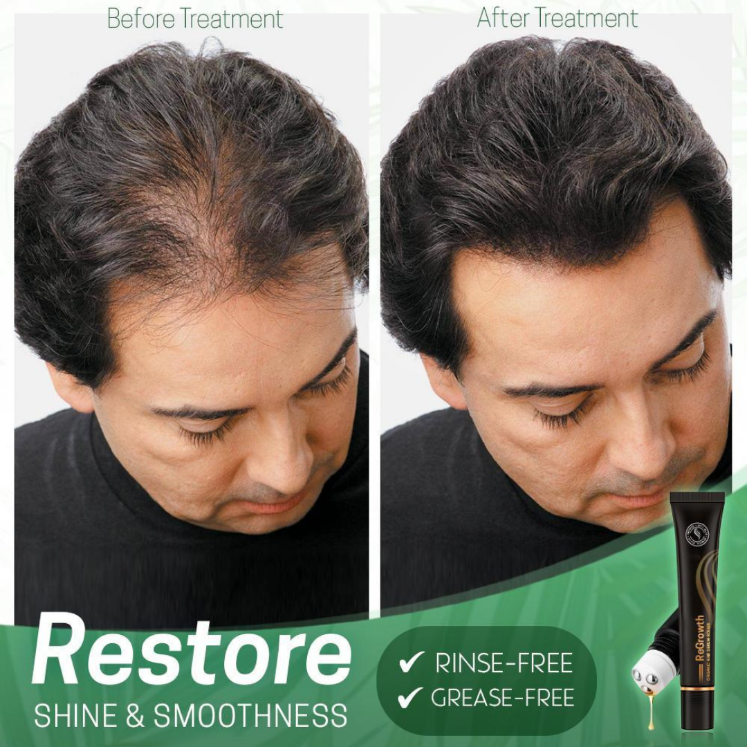 Revitalize Bio Hair Serum™ | Fördere dein Haarwachstum – 1+1 GRATIS Angebot!
