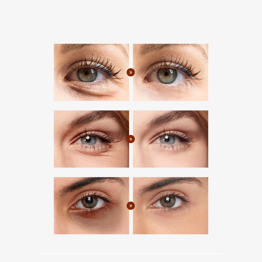 Cayman Augencreme™ | Ihre optimale Lösung für strahlende, frische Augen! (Jetzt 1+1 GRATIS sichern!)
