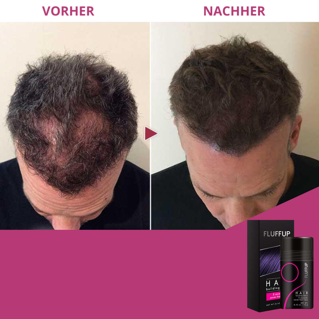 FluffUp™ Keratin Powder | Bekämpfen Sie Haarausfall (1+1 GRATIS)