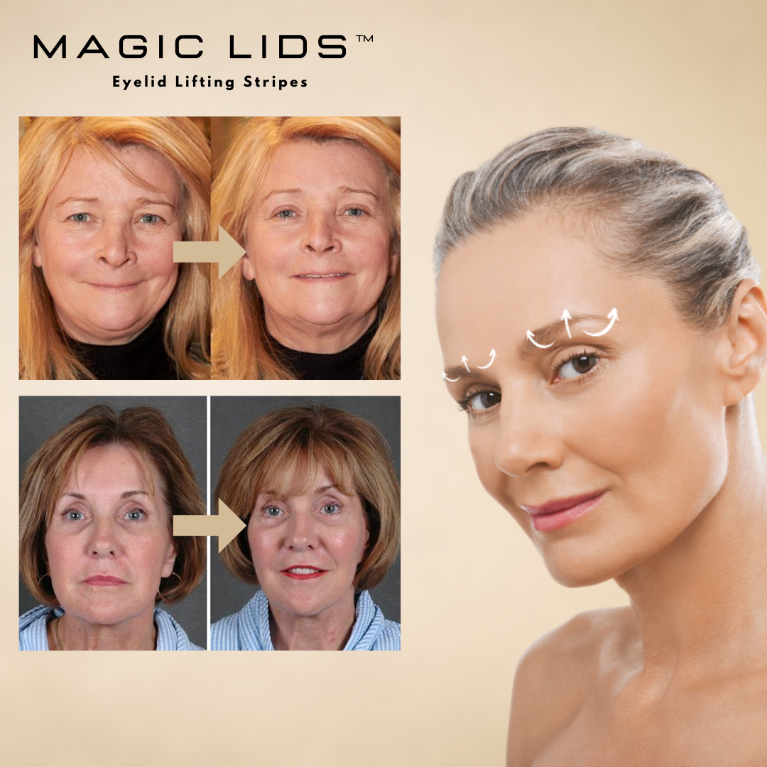 MagicLids™ | Natürlich Schönheit für Ihre Augen – Jahrespaket mit Augenlidstrips
