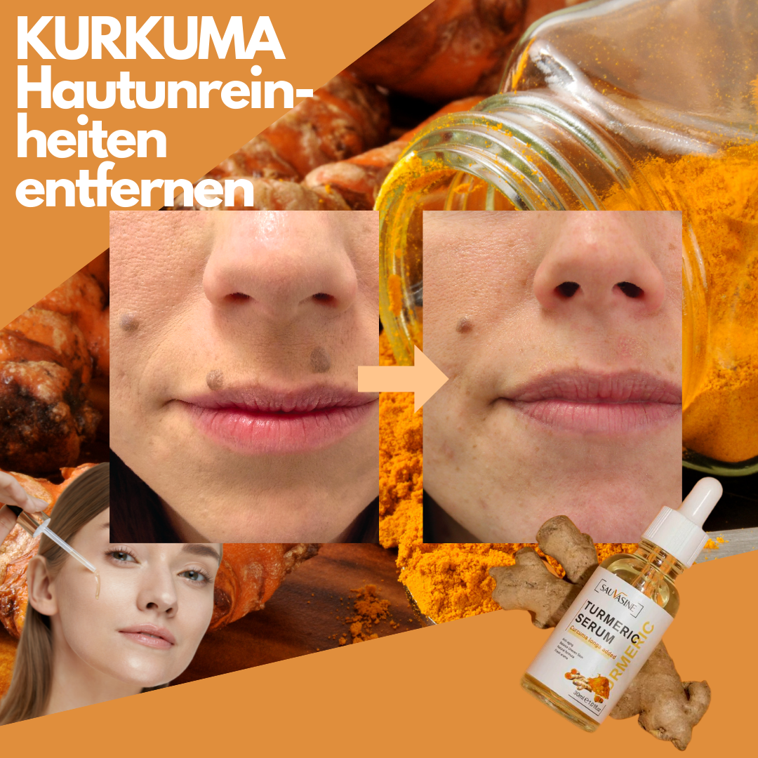 DermaSkin™ | Fleckenentferner-Serum – Holen Sie sich 1 GRATIS dazu!