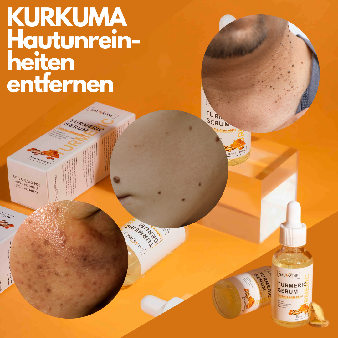 DermaSkin™ | Fleckenentferner-Serum – Holen Sie sich 1 GRATIS dazu!