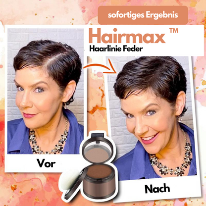 Hairmax Haarlinie Feder™ | Die ultimative Lösung für mehr Volumen und ein volleres Haarbild